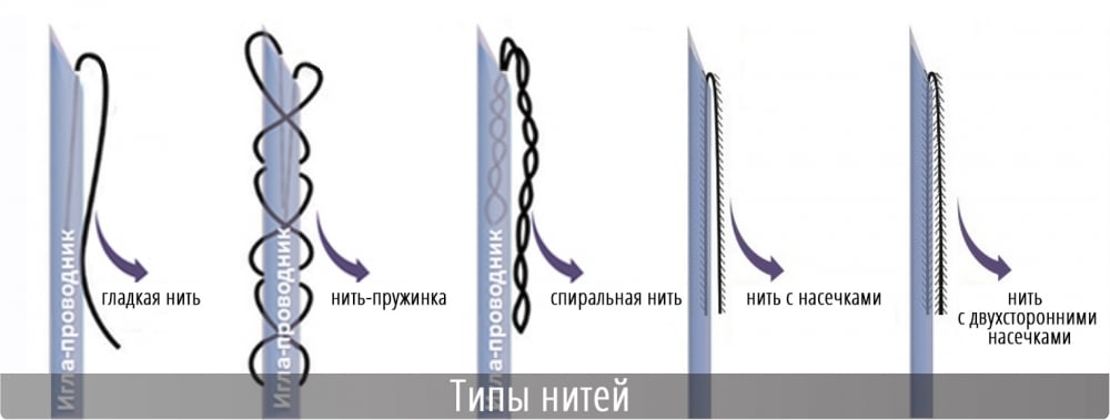 Виды нитей для нитевой подтяжки лица